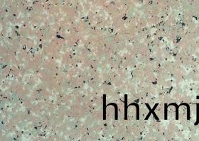 液態(tài)蘤崗巗 